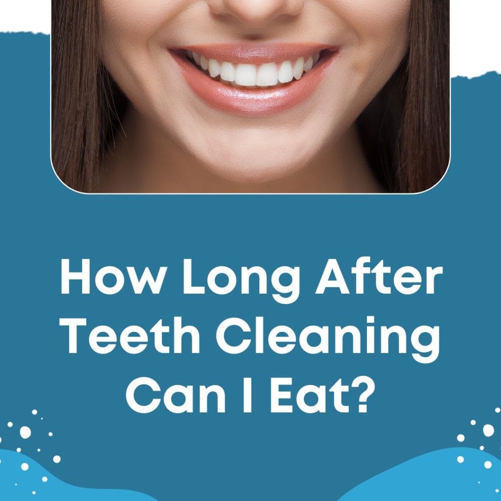 How Long After Teeth Cleaning Can Eat